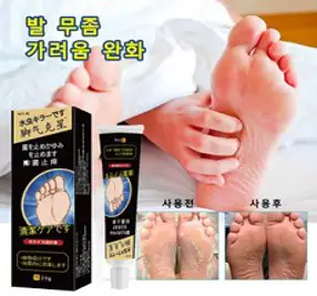 무좀 연고 발무좀 항균제 가려움증 연고 피부 외용 크림 20g, 2개